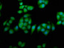 Immunofluorescence staining of Hela cells with CAC11395 at 1:233, counter-stained with DAPI. The cells were fixed in 4% formaldehyde, permeabilized using 0.2% Triton X-100 and blocked in 10% normal Goat Serum. The cells were then incubated with the antibody overnight at 4°C. The secondary antibody was Alexa Fluor 488-congugated AffiniPure Goat Anti-Rabbit IgG(H+L).