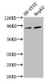 Western Blot; Positive WB detected in: SH-SY5Y whole cell lysate, HepG2 whole cell lysate; All lanes: DPY19L3 antibody at 3.4µg/ml; Secondary; Goat polyclonal to rabbit IgG at 1/50000 dilution; Predicted band size: 84, 63 kDa; Observed band size: 84 kDa