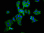 Immunofluorescence staining of HepG2 cells with CAC11398 at 1:200, counter-stained with DAPI. The cells were fixed in 4% formaldehyde, permeabilized using 0.2% Triton X-100 and blocked in 10% normal Goat Serum. The cells were then incubated with the antibody overnight at 4°C. The secondary antibody was Alexa Fluor 488-congugated AffiniPure Goat Anti-Rabbit IgG(H+L).