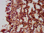 IHC image of CAC11400 diluted at 1:400 and staining in paraffin-embedded human lung tissue performed on a Leica BondTM system. After dewaxing and hydration, antigen retrieval was mediated by high pressure in a citrate buffer (pH 6.0). Section was blocked with 10% normal goat serum 30min at RT. Then primary antibody (1% BSA) was incubated at 4°C overnight. The primary is detected by a biotinylated secondary antibody and visualized using an HRP conjugated SP system.