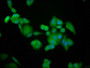 Immunofluorescence staining of PC-3 cells with CAC11401 at 1:100, counter-stained with DAPI. The cells were fixed in 4% formaldehyde, permeabilized using 0.2% Triton X-100 and blocked in 10% normal Goat Serum. The cells were then incubated with the antibody overnight at 4°C. The secondary antibody was Alexa Fluor 488-congugated AffiniPure Goat Anti-Rabbit IgG(H+L).
