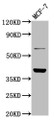 Western Blot; Positive WB detected in: MCF-7 whole cell lysate; All lanes: LAPTM4B antibody at 4.8µg/ml; Secondary; Goat polyclonal to rabbit IgG at 1/50000 dilution; Predicted band size: 42, 26, 36 kDa; Observed band size: 42 kDa;