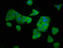 Immunofluorescence staining of HepG2 cells with CAC11408 at 1:166, counter-stained with DAPI. The cells were fixed in 4% formaldehyde, permeabilized using 0.2% Triton X-100 and blocked in 10% normal Goat Serum. The cells were then incubated with the antibody overnight at 4°C. The secondary antibody was Alexa Fluor 488-congugated AffiniPure Goat Anti-Rabbit IgG(H+L).