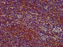 IHC image of CAC11409 diluted at 1:400 and staining in paraffin-embedded human lymph node tissue performed on a Leica BondTM system. After dewaxing and hydration, antigen retrieval was mediated by high pressure in a citrate buffer (pH 6.0). Section was blocked with 10% normal goat serum 30min at RT. Then primary antibody (1% BSA) was incubated at 4°C overnight. The primary is detected by a biotinylated secondary antibody and visualized using an HRP conjugated SP system.