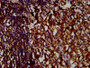 IHC image diluted at 1:400 and staining in paraffin-embedded human tonsil tissue performed on a Leica BondTM system. After dewaxing and hydration, antigen retrieval was mediated by high pressure in a citrate buffer (pH 6.0). Section was blocked with 10% normal goat serum 30min at RT. Then primary antibody (1% BSA) was incubated at 4°C overnight. The primary is detected by a biotinylated secondary antibody and visualized using an HRP conjugated SP system.