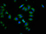 Immunofluorescence staining of A549 cells with CAC11412 at 1:266, counter-stained with DAPI. The cells were fixed in 4% formaldehyde, permeabilized using 0.2% Triton X-100 and blocked in 10% normal Goat Serum. The cells were then incubated with the antibody overnight at 4°C. The secondary antibody was Alexa Fluor 488-congugated AffiniPure Goat Anti-Rabbit IgG(H+L).