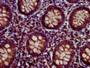 IHC image diluted at 1:500 and staining in paraffin-embedded human appendix tissue performed on a Leica BondTM system. After dewaxing and hydration, antigen retrieval was mediated by high pressure in a citrate buffer (pH 6.0). Section was blocked with 10% normal goat serum 30min at RT. Then primary antibody (1% BSA) was incubated at 4°C overnight. The primary is detected by a biotinylated secondary antibody and visualized using an HRP conjugated SP system.