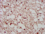 IHC image diluted at 1:400 and staining in paraffin-embedded human brain tissue performed on a Leica BondTM system. After dewaxing and hydration, antigen retrieval was mediated by high pressure in a citrate buffer (pH 6.0). Section was blocked with 10% normal goat serum 30min at RT. Then primary antibody (1% BSA) was incubated at 4°C overnight. The primary is detected by a biotinylated secondary antibody and visualized using an HRP conjugated SP system.