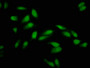 Immunofluorescence staining of Hela cells with CAC11417 at 1:133, counter-stained with DAPI. The cells were fixed in 4% formaldehyde, permeabilized using 0.2% Triton X-100 and blocked in 10% normal Goat Serum. The cells were then incubated with the antibody overnight at 4°C. The secondary antibody was Alexa Fluor 488-congugated AffiniPure Goat Anti-Rabbit IgG(H+L).