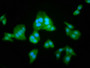 Immunofluorescence staining of HepG2 cells with CAC11418 at 1:100, counter-stained with DAPI. The cells were fixed in 4% formaldehyde, permeabilized using 0.2% Triton X-100 and blocked in 10% normal Goat Serum. The cells were then incubated with the antibody overnight at 4°C. The secondary antibody was Alexa Fluor 488-congugated AffiniPure Goat Anti-Rabbit IgG(H+L).