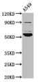 Western Blot; Positive WB detected in: A549 whole cell lysate; All lanes: PIGV antibody at 4.6µg/ml; Secondary; Goat polyclonal to rabbit IgG at 1/50000 dilution; Predicted band size: 56 kDa; Observed band size: 56 kDa