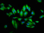 Immunofluorescence staining of Hela cells with CAC11419 at 1:66, counter-stained with DAPI. The cells were fixed in 4% formaldehyde, permeabilized using 0.2% Triton X-100 and blocked in 10% normal Goat Serum. The cells were then incubated with the antibody overnight at 4°C. The secondary antibody was Alexa Fluor 488-congugated AffiniPure Goat Anti-Rabbit IgG(H+L).