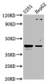 Western Blot; Positive WB detected in: U251 whole cell lysate, HepG2 whole cell lysate; All lanes: C1GALT1 antibody at 4.4µg/ml; Secondary; Goat polyclonal to rabbit IgG at 1/50000 dilution; Predicted band size: 43, 36 kDa; Observed band size: 43 kDa