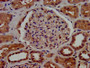 IHC image diluted at 1:1000 and staining in paraffin-embedded human kidney tissue performed on a Leica BondTM system. After dewaxing and hydration, antigen retrieval was mediated by high pressure in a citrate buffer (pH 6.0). Section was blocked with 10% normal goat serum 30min at RT. Then primary antibody (1% BSA) was incubated at 4°C overnight. The primary is detected by a biotinylated secondary antibody and visualized using an HRP conjugated SP system.