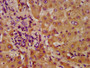 IHC image of CAC11426 diluted at 1:600 and staining in paraffin-embedded human liver tissue performed on a Leica BondTM system. After dewaxing and hydration, antigen retrieval was mediated by high pressure in a citrate buffer (pH 6.0). Section was blocked with 10% normal goat serum 30min at RT. Then primary antibody (1% BSA) was incubated at 4°C overnight. The primary is detected by a biotinylated secondary antibody and visualized using an HRP conjugated SP system.