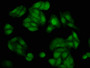 Immunofluorescence staining of HepG2 cells with CAC11426 at 1:200, counter-stained with DAPI. The cells were fixed in 4% formaldehyde, permeabilized using 0.2% Triton X-100 and blocked in 10% normal Goat Serum. The cells were then incubated with the antibody overnight at 4°C. The secondary antibody was Alexa Fluor 488-congugated AffiniPure Goat Anti-Rabbit IgG(H+L).