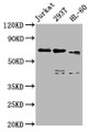 Western Blot; Positive WB detected in: Jurkat whole cell lysate, 293T whole cell lysate, HL60 whole cell lysate; All lanes: CBFA2T3 antibody at 5µg/ml; Secondary; Goat polyclonal to rabbit IgG at 1/50000 dilution; Predicted band size: 72, 63, 64, 8 kDa; Observed band size: 72 kDa