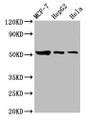 Western Blot; Positive WB detected in: MCF-7 whole cell lysate, HepG2 whole cell lysate, Hela whole cell lysate; All lanes: GBA antibody at 3.6µg/ml; Secondary; Goat polyclonal to rabbit IgG at 1/50000 dilution; Predicted band size: 60, 58, 30, 51, 55 kDa; Observed band size: 51 kDa