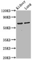 Western Blot; Positive WB detected in: Rat kidney tissue, Mouse lung tissue; All lanes: SRRM4 antibody at 4.2µg/ml; Secondary; Goat polyclonal to rabbit IgG at 1/50000 dilution; Predicted band size: 69 kDa; Observed band size: 69 kDa;