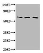 Western Blot; Positive WB detected in: Hela whole cell lysate, Rat brain tissue, Mouse brain tissue; All lanes: PHACTR1 antibody at 6µg/ml; Secondary; Goat polyclonal to rabbit IgG at 1/50000 dilution; Predicted band size: 67, 55 kDa; Observed band size: 67 kDa