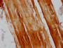 IHC image diluted at 1:200 and staining in paraffin-embedded human skeletal muscle tissue performed on a Leica BondTM system. After dewaxing and hydration, antigen retrieval was mediated by high pressure in a citrate buffer (pH 6.0). Section was blocked with 10% normal goat serum 30min at RT. Then primary antibody (1% BSA) was incubated at 4°C overnight. The primary is detected by a biotinylated secondary antibody and visualized using an HRP conjugated SP system.