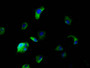 Immunofluorescence staining of MCF-7 cells with CAC11461 at 1:166, counter-stained with DAPI. The cells were fixed in 4% formaldehyde, permeabilized using 0.2% Triton X-100 and blocked in 10% normal Goat Serum. The cells were then incubated with the antibody overnight at 4°C. The secondary antibody was Alexa Fluor 488-congugated AffiniPure Goat Anti-Rabbit IgG(H+L).
