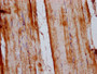 IHC image diluted at 1:200 and staining in paraffin-embedded human skeletal muscle tissue performed on a Leica BondTM system. After dewaxing and hydration, antigen retrieval was mediated by high pressure in a citrate buffer (pH 6.0). Section was blocked with 10% normal goat serum 30min at RT. Then primary antibody (1% BSA) was incubated at 4°C overnight. The primary is detected by a biotinylated secondary antibody and visualized using an HRP conjugated SP system.