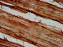 IHC image of CAC11467 diluted at 1:500 and staining in paraffin-embedded human skeletal muscle tissue performed on a Leica BondTM system. After dewaxing and hydration, antigen retrieval was mediated by high pressure in a citrate buffer (pH 6.0). Section was blocked with 10% normal goat serum 30min at RT. Then primary antibody (1% BSA) was incubated at 4°C overnight. The primary is detected by a biotinylated secondary antibody and visualized using an HRP conjugated SP system.