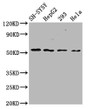 Western Blot; Positive WB detected in: SH-SY5Y whole cell lysate, HepG2 whole cell lysate, 293 whole cell lysate, Hela whole cell lysate; All lanes: SLC19A3 antibody at 3.6µg/ml; Secondary; Goat polyclonal to rabbit IgG at 1/50000 dilution; Predicted band size: 56 kDa; Observed band size: 56 kDa