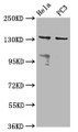 Western Blot; Positive WB detected in: Hela whole cell lysate, PC-3 whole cell lysate; All lanes: MOV10L1 antibody at 6.5µg/ml; Secondary; Goat polyclonal to rabbit IgG at 1/50000 dilution; Predicted band size: 136, 38, 14, 130, 131 kDa; Observed band size: 136 kDa