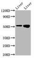Western Blot; Positive WB detected in: Rat liver tissue, Mouse liver tissue; All lanes: PRSS16 antibody at 3.2µg/ml; Secondary; Goat polyclonal to rabbit IgG at 1/50000 dilution; Predicted band size: 56 kDa; Observed band size: 56 kDa;