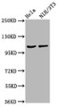 Western Blot; Positive WB detected in: Hela whole cell lysate, NIH/3T3 whole cell lysate; All lanes: MKL2 antibody at 4.2µg/ml; Secondary; Goat polyclonal to rabbit IgG at 1/50000 dilution; Predicted band size: 119, 43, 52, 115, 120 kDa; Observed band size: 119 kDa;