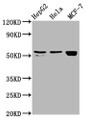 Western Blot; Positive WB detected in: HepG2 whole cell lysate, Hela whole cell lysate, MCF-7 whole cell lysate; All lanes: DHCR7 antibody at 2.4µg/ml; Secondary; Goat polyclonal to rabbit IgG at 1/50000 dilution; Predicted band size: 55 kDa; Observed band size: 55 kDa