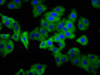 Immunofluorescence staining of HepG2 cells with CAC11492 at 1:133, counter-stained with DAPI. The cells were fixed in 4% formaldehyde, permeabilized using 0.2% Triton X-100 and blocked in 10% normal Goat Serum. The cells were then incubated with the antibody overnight at 4°C. The secondary antibody was Alexa Fluor 488-congugated AffiniPure Goat Anti-Rabbit IgG(H+L).