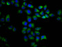 Immunofluorescence staining of Hela cells with CAC11496 at 1:200, counter-stained with DAPI. The cells were fixed in 4% formaldehyde, permeabilized using 0.2% Triton X-100 and blocked in 10% normal Goat Serum. The cells were then incubated with the antibody overnight at 4°C. The secondary antibody was Alexa Fluor 488-congugated AffiniPure Goat Anti-Rabbit IgG(H+L).