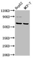 Western Blot; Positive WB detected in: HepG2 whole cell lysate, MCF-7 whole cell lysate; All lanes: FPGS antibody at 3.2µg/ml; Secondary; Goat polyclonal to rabbit IgG at 1/50000 dilution; Predicted band size: 65, 61, 60, 62 kDa; Observed band size: 65 kDa