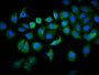 Immunofluorescence staining of A549 cells with CAC11500 at 1:133, counter-stained with DAPI. The cells were fixed in 4% formaldehyde, permeabilized using 0.2% Triton X-100 and blocked in 10% normal Goat Serum. The cells were then incubated with the antibody overnight at 4°C. The secondary antibody was Alexa Fluor 488-congugated AffiniPure Goat Anti-Rabbit IgG(H+L).