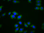 Immunofluorescence staining of A549 cells with CAC11501 at 1:166, counter-stained with DAPI. The cells were fixed in 4% formaldehyde, permeabilized using 0.2% Triton X-100 and blocked in 10% normal Goat Serum. The cells were then incubated with the antibody overnight at 4°C. The secondary antibody was Alexa Fluor 488-congugated AffiniPure Goat Anti-Rabbit IgG(H+L).