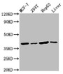 Western Blot; Positive WB detected in: MCF-7 whole cell lysate, 293T whole cell lysate, HepG2 whole cell lysate, Mouse liver tissue; All lanes: IBA57 antibody at 4.5µg/ml; Secondary; Goat polyclonal to rabbit IgG at 1/50000 dilution; Predicted band size: 39 kDa; Observed band size: 39 kDa