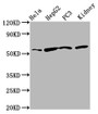 Western Blot; Positive WB detected in: Hela whole cell lysate, HepG2 whole cell lysate, PC-3 whole cell lysate, Rat kidney tissue; All lanes: TTI2 antibody at 8.7µg/ml; Secondary; Goat polyclonal to rabbit IgG at 1/50000 dilution; Predicted band size: 57 kDa; Observed band size: 57 kDa