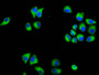 Immunofluorescence staining of Hela cells with CAC11511 at 1:133, counter-stained with DAPI. The cells were fixed in 4% formaldehyde, permeabilized using 0.2% Triton X-100 and blocked in 10% normal Goat Serum. The cells were then incubated with the antibody overnight at 4°C. The secondary antibody was Alexa Fluor 488-congugated AffiniPure Goat Anti-Rabbit IgG(H+L).