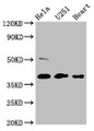 Western Blot; Positive WB detected in: Hela whole cell lysate, U251 whole cell lysate, Mouse heart tissue; All lanes: RCN3 antibody at 4.6µg/ml; Secondary; Goat polyclonal to rabbit IgG at 1/50000 dilution; Predicted band size: 38 kDa; Observed band size: 38 kDa