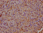 IHC image of CAC11515 diluted at 1:400 and staining in paraffin-embedded human pancreatic tissue performed on a Leica BondTM system. After dewaxing and hydration, antigen retrieval was mediated by high pressure in a citrate buffer (pH 6.0). Section was blocked with 10% normal goat serum 30min at RT. Then primary antibody (1% BSA) was incubated at 4°C overnight. The primary is detected by a biotinylated secondary antibody and visualized using an HRP conjugated SP system.