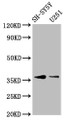 Western Blot; Positive WB detected in: SH-SY5Y whole cell lysate, U251 whole cell lysate; All lanes: BARHL1 antibody at 3.4µg/ml; Secondary; Goat polyclonal to rabbit IgG at 1/50000 dilution; Predicted band size: 36 kDa; Observed band size: 36 kDa