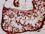 IHC image diluted at 1:400 and staining in paraffin-embedded human testis tissue performed on a Leica BondTM system. After dewaxing and hydration, antigen retrieval was mediated by high pressure in a citrate buffer (pH 6.0). Section was blocked with 10% normal goat serum 30min at RT. Then primary antibody (1% BSA) was incubated at 4°C overnight. The primary is detected by a biotinylated secondary antibody and visualized using an HRP conjugated SP system.