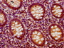 IHC image of CAC11519 diluted at 1:200 and staining in paraffin-embedded human appendix tissue performed on a Leica BondTM system. After dewaxing and hydration, antigen retrieval was mediated by high pressure in a citrate buffer (pH 6.0). Section was blocked with 10% normal goat serum 30min at RT. Then primary antibody (1% BSA) was incubated at 4°C overnight. The primary is detected by a biotinylated secondary antibody and visualized using an HRP conjugated SP system.