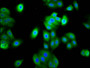 Immunofluorescence staining of HepG2 cells with CAC11521 at 1:133, counter-stained with DAPI. The cells were fixed in 4% formaldehyde, permeabilized using 0.2% Triton X-100 and blocked in 10% normal Goat Serum. The cells were then incubated with the antibody overnight at 4°C. The secondary antibody was Alexa Fluor 488-congugated AffiniPure Goat Anti-Rabbit IgG(H+L).