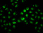 Immunofluorescence staining of Hela cells with CAC11525 at 1:100, counter-stained with DAPI. The cells were fixed in 4% formaldehyde, permeabilized using 0.2% Triton X-100 and blocked in 10% normal Goat Serum. The cells were then incubated with the antibody overnight at 4°C. The secondary antibody was Alexa Fluor 488-congugated AffiniPure Goat Anti-Rabbit IgG(H+L).