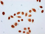 Immunocytochemistry analysis diluted at 1:20 and staining in Hela cells (treated with 30mM sodium butyrate for 4h) performed on a Leica BondTM system. The cells were fixed in 4% formaldehyde, permeabilized using 0.2% Triton X-100 and blocked with 10% normal goat serum 30min at RT. Then primary antibody (1% BSA) was incubated at 4°C overnight. The primary is detected by a biotinylated secondary antibody and visualized using an HRP conjugated SP system.