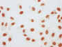 Immunocytochemistry analysis diluted at 1:50 and staining in Hela cells (treated with 50mM sodium 3-hydroxybutyrate for 4h) performed on a Leica BondTM system. The cells were fixed in 4% formaldehyde, permeabilized using 0.2% Triton X-100 and blocked with 10% normal goat serum 30min at RT. Then primary antibody (1% BSA) was incubated at 4°C overnight. The primary is detected by a biotinylated secondary antibody and visualized using an HRP conjugated SP system.